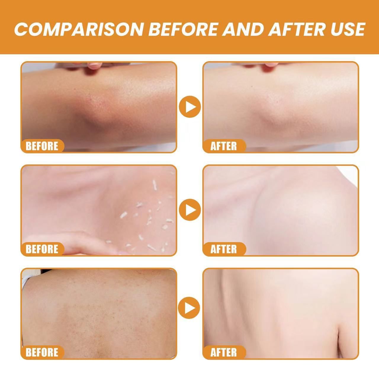 Orange Exfoliating Gel Scrub Face Body Skin, Orange Exfoliating Gel, Natural Orange Peeling Gel Face Scrub