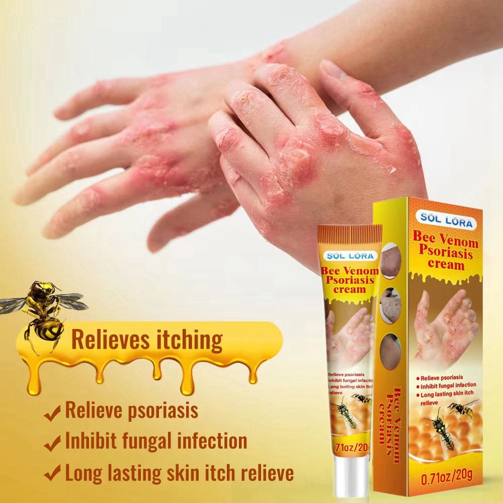 2pcs SOL LORA Bee Venom Skin Itch Relief and Scalp Fungal Infection Repair Cream