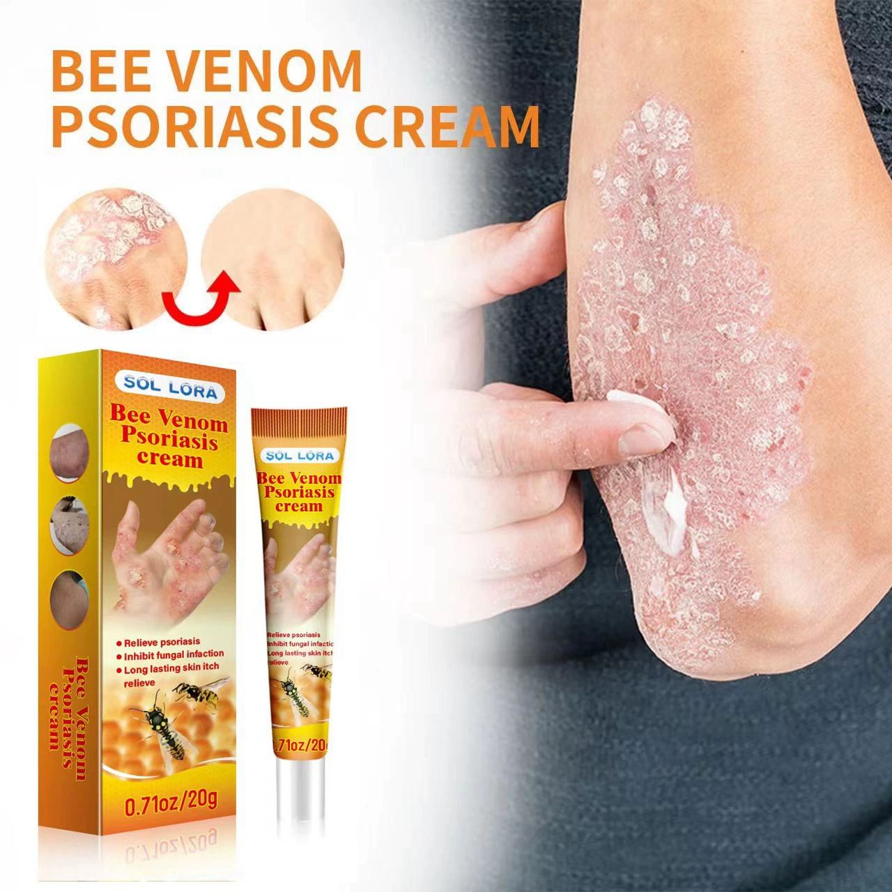 2pcs SOL LORA Bee Venom Skin Itch Relief and Scalp Fungal Infection Repair Cream