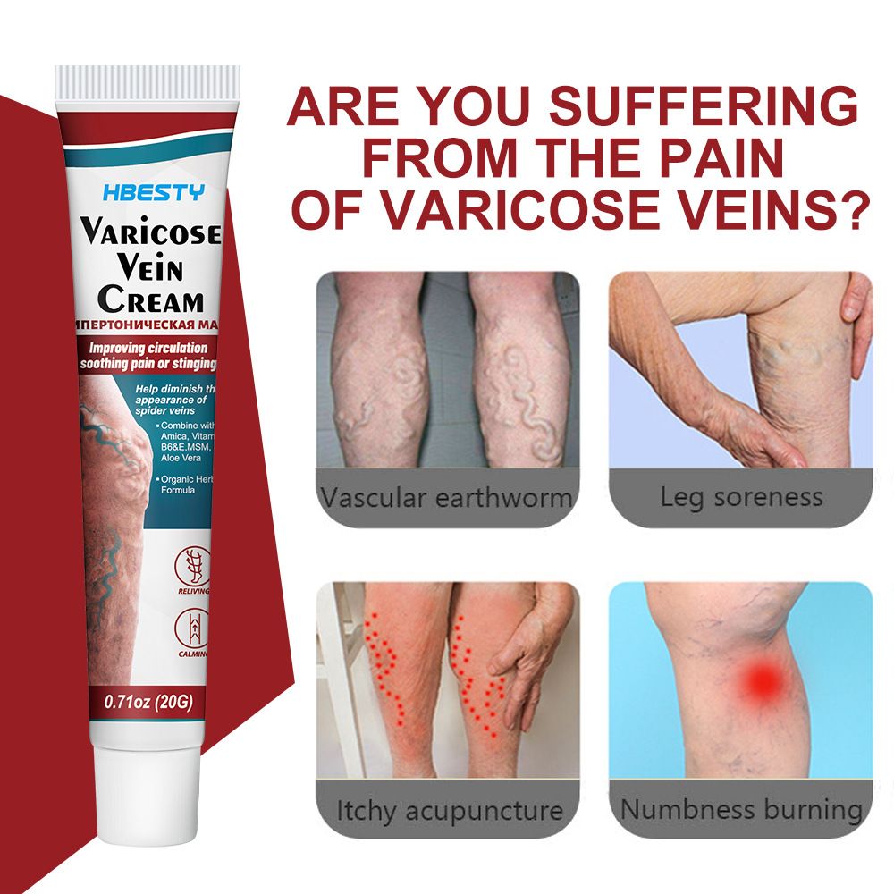 2PCS Varicose Veins treatment for legs,Anti Varicose Vein Soothing Leg Cream,Improves Blood Circulation, Reduces Varicose Veins and Heaviness Lymphatic Massage Cream 20G/0.70OZ