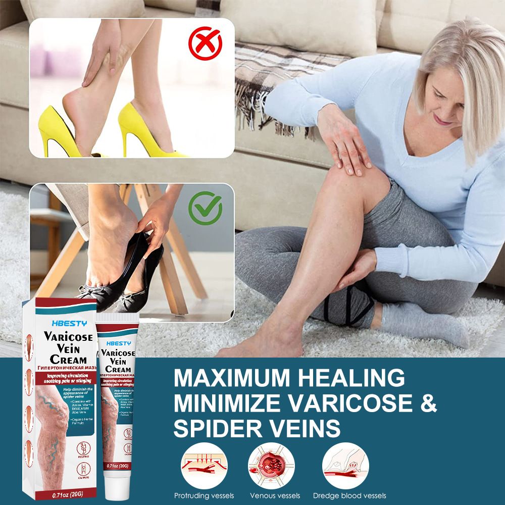 2PCS Varicose Veins treatment for legs,Anti Varicose Vein Soothing Leg Cream,Improves Blood Circulation, Reduces Varicose Veins and Heaviness Lymphatic Massage Cream 20G/0.70OZ