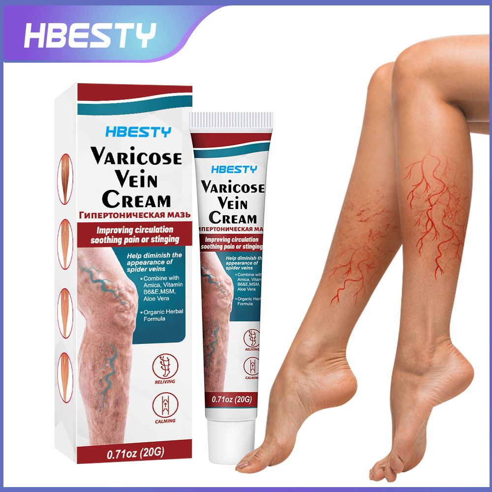 2PCS Varicose Veins treatment for legs,Anti Varicose Vein Soothing Leg Cream,Improves Blood Circulation, Reduces Varicose Veins and Heaviness Lymphatic Massage Cream 20G/0.70OZ