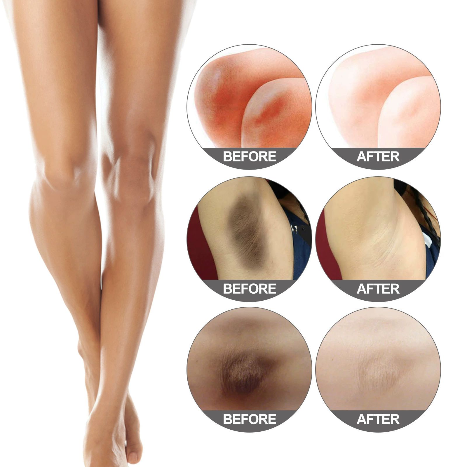 Armpit Thigh Darkening Cream Snow Bleach Cream - Whitening for Private Parts, Underarms & Dark Spot Removal - Gentle Skin Lightening 1 set