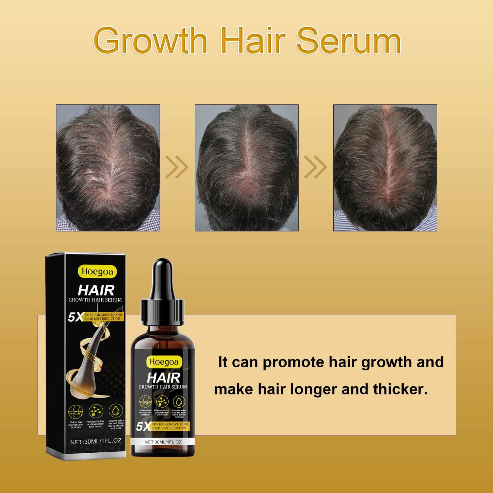 for Men & Women, Advanced Formula Hair Regrowth Spray and Topical Solution for Thinning Hair and Beard, Long-Lasting Results