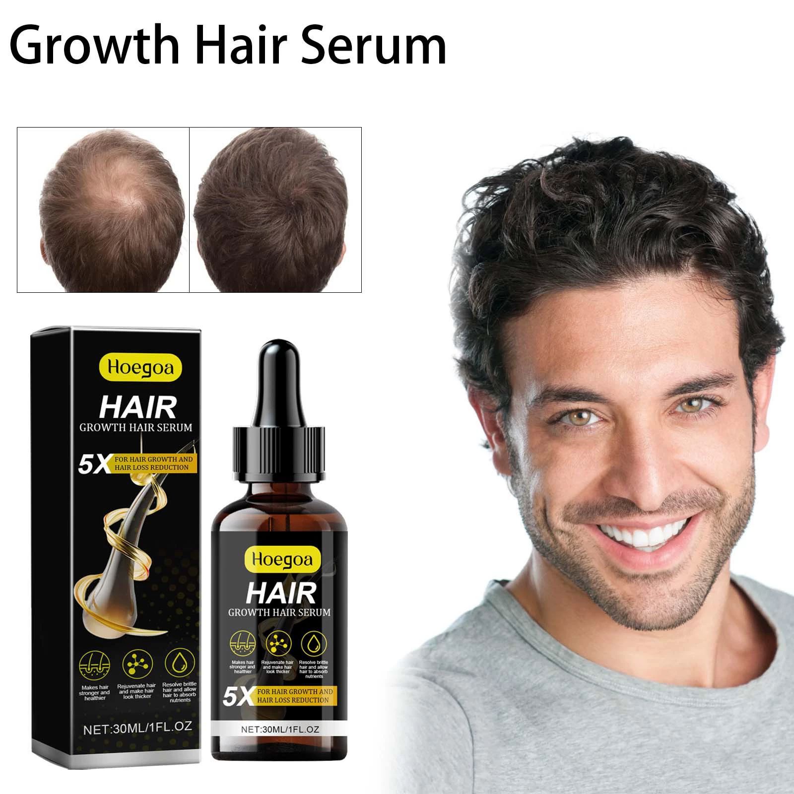 for Men & Women, Advanced Formula Hair Regrowth Spray and Topical Solution for Thinning Hair and Beard, Long-Lasting Results