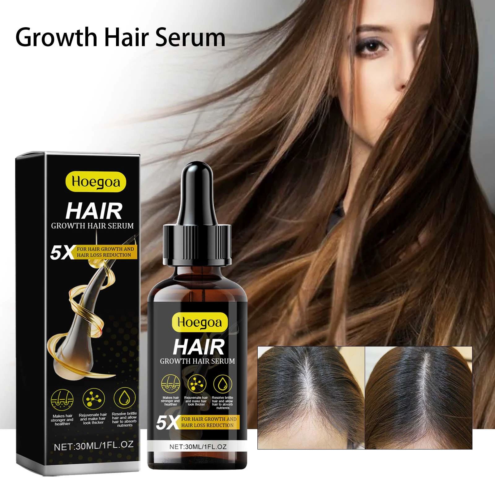 for Men & Women, Advanced Formula Hair Regrowth Spray and Topical Solution for Thinning Hair and Beard, Long-Lasting Results