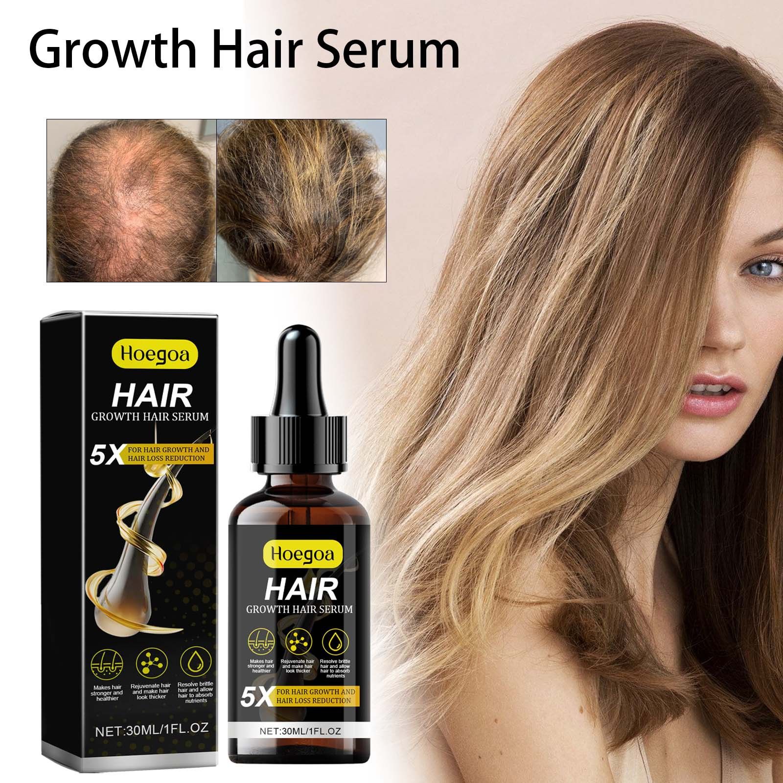 for Men & Women, Advanced Formula Hair Regrowth Spray and Topical Solution for Thinning Hair and Beard, Long-Lasting Results