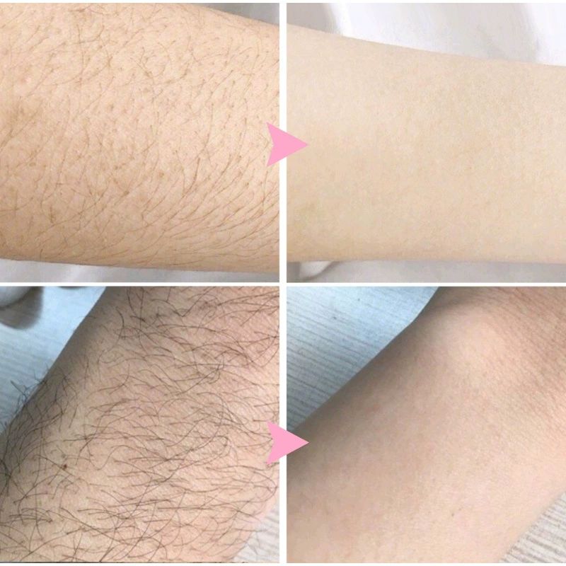 Hair Removal Spray, Mild Painless Facial Hair Remover Cream for Underarm, Arm, Leg, Bikini Areas Body Hair Depilatories Product for Women Men 30ml
