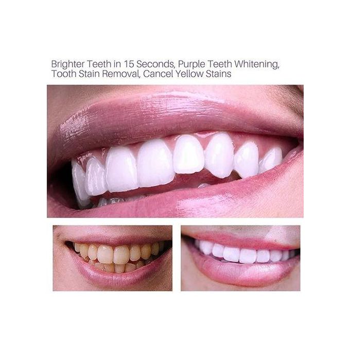 Lanthome V34 teeth whitening and stain remover mousse Colour Corrector restores brightness and neutralises yellow tones on the tooth surface