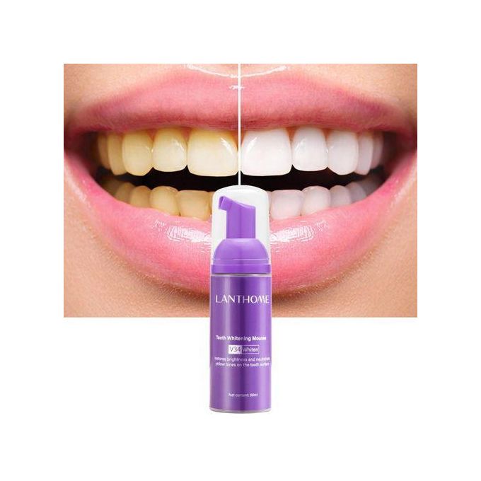 Lanthome V34 teeth whitening and stain remover mousse Colour Corrector restores brightness and neutralises yellow tones on the tooth surface