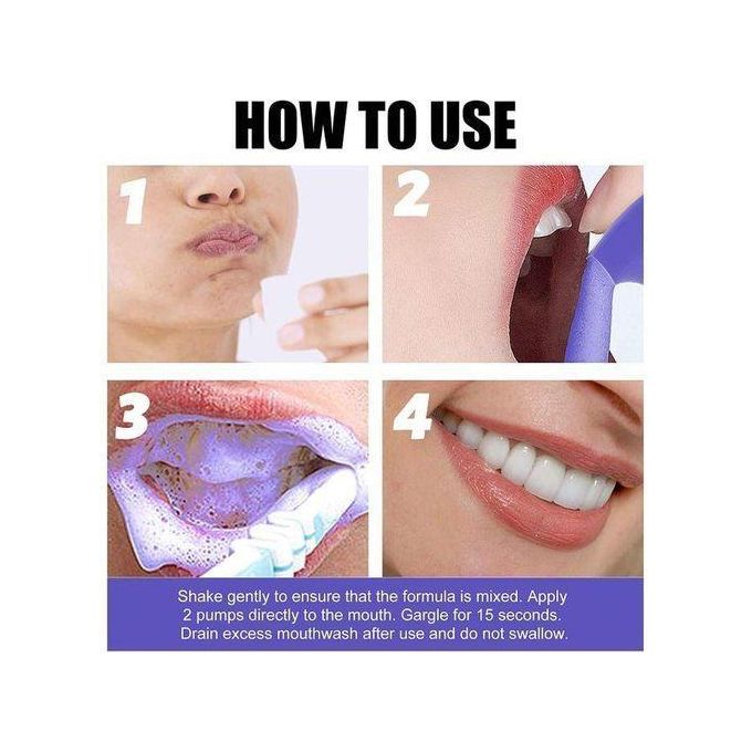 Lanthome V34 teeth whitening and stain remover mousse Colour Corrector restores brightness and neutralises yellow tones on the tooth surface