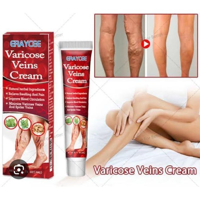 ERAYCEE Varicose Vein Cream - Spider Vein Treatment, Leg Circulation & Pain Relief, Skin Firming