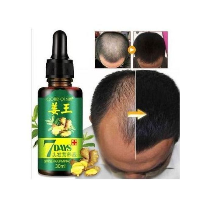 7 Day Ginger Germinal Oil Hair Growth -7day-