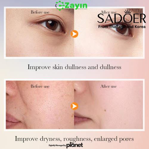 ,Vitamin C skincare set
SADOER Vitamin C products
Brightening skincare Thailand Korea
Anti-aging face set
Hydrating face cream Vitamin C
Best skincare gift set 2025
Korean skincare routine
SADOER