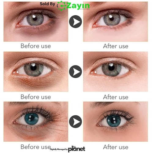 Rice Eye Cream, Rice Extract Eye Serum, Puffiness Removal Cream, Anti-Wrinkle Eye Cream, Eye Bag Cream, Dark Circles Eye Treatment, Brightening Eye Cream, Under Eye Moisturizer, Non-Greasy Eye Gel,