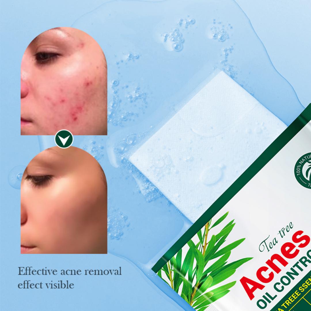 10 SADOER Tea Tree Acne Removing Facial Mask is a sheet mask designed to address acne and oily skin concerns.Formulated with tea tree essential oil,Natural antibacterial and anti-inflammatory.
