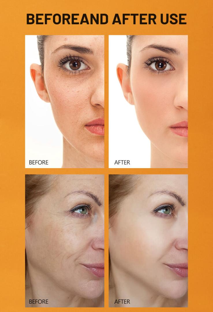 Introducing the Dissar Papaya Skin Care Product, infused with nourishing Vitamin E! This new face whitening cream is designed for daily use, helping you achieve a radiant and rejuvenated complexion.