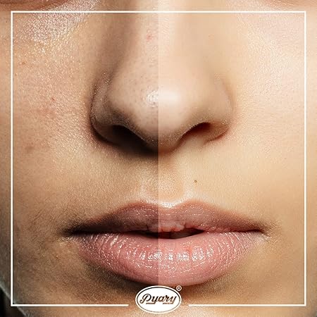 Pyary Ayurvedic Turmeric Soap is a natural and herbal soap made from pure coconut oil and enriched with the goodness of turmeric. This unique soap is formulated to provide deep cleansing