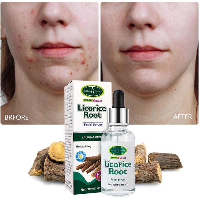 Revitalize your skin with Aichun Beauty's Licorice Root Anti-Inflammatory Facial Serum (30ml) and nourishing Face Cream (50g). This powerful duo delivers soothing hydration and a radiant complexion