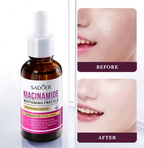 SADOER Radiance Repair Niacinamide Serum, Dark Spot Corrector, Freckle-Fading Nicotinamide Treatment for Brightening, Barrier Repair & Even Skin Tone Glow works like Garnier, Whitening, Hydrating