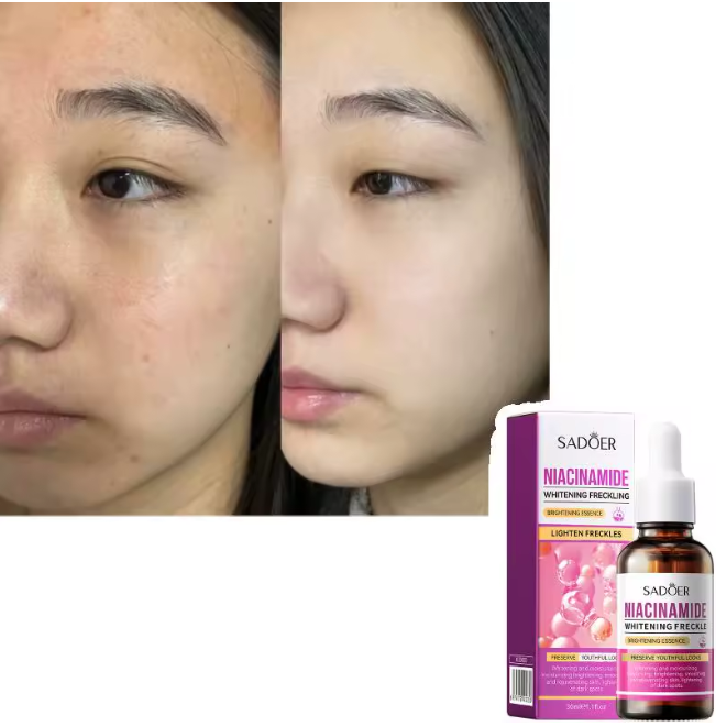 SADOER Radiance Repair Niacinamide Serum, Dark Spot Corrector, Freckle-Fading Nicotinamide Treatment for Brightening, Barrier Repair & Even Skin Tone Glow works like Garnier, Whitening, Hydrating