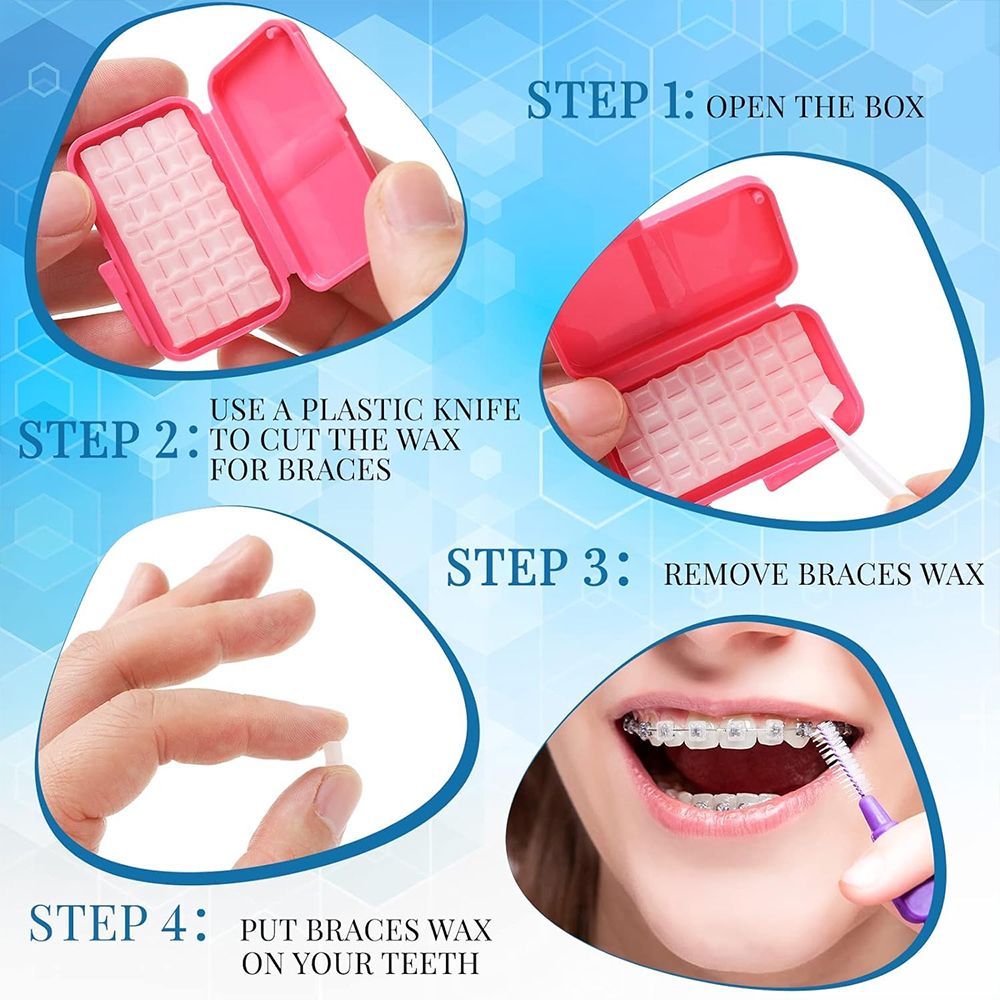 1Box Fruit Scent Dental Orthodontic Wax Oral Hygiene Teeth Whitening Materials Relief Wax Sticks for Braces Gum Irritation Dental Orthodontic Wax for Braces - Pain Relief & Comfort Easy to Apply