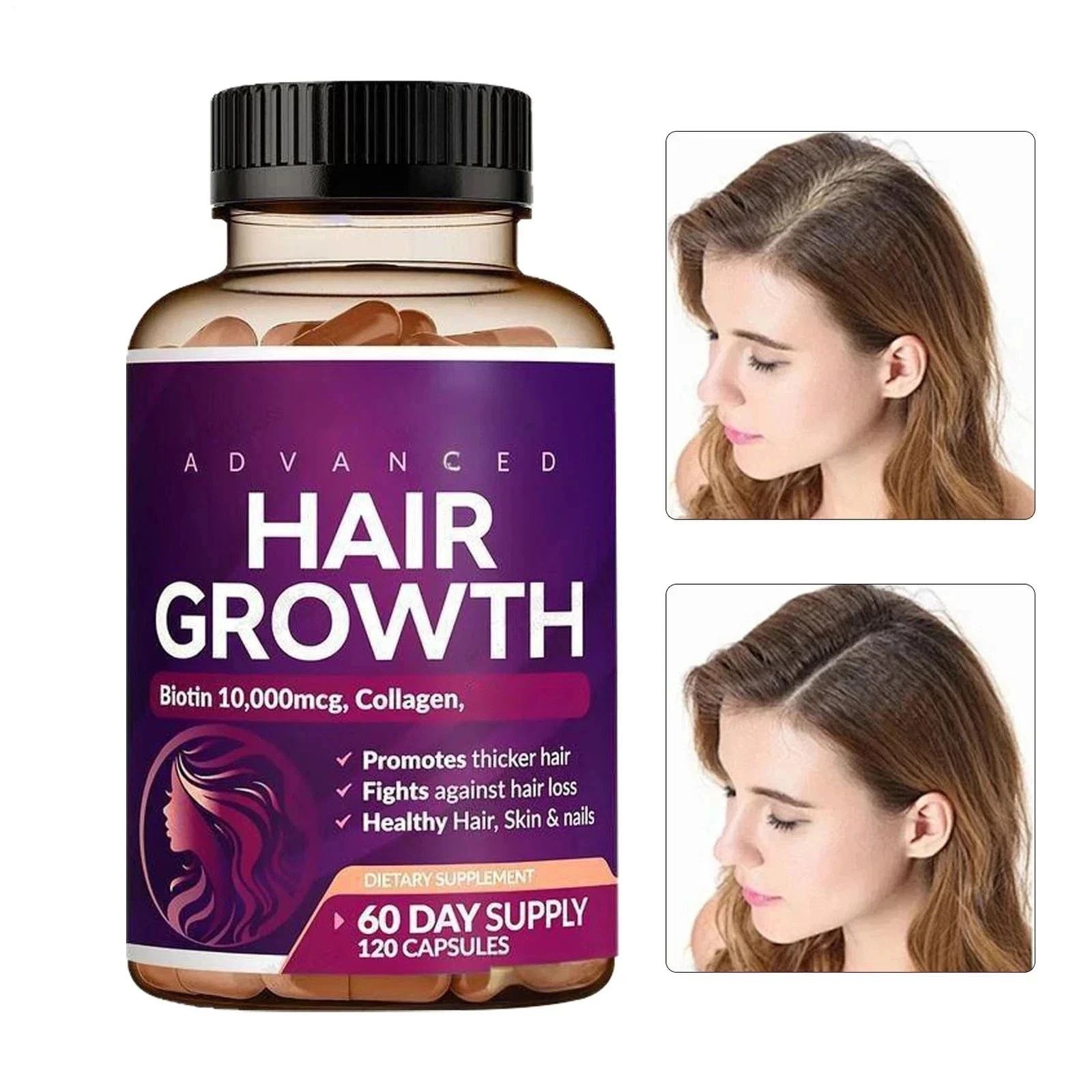 120 Women's Biotin Capsules with Vitamin Collagen Saw Palmetto allows women to supplement with vitamin C and zinc from within, supporting skin elasticity, hair growth and nail strength Vegetarian