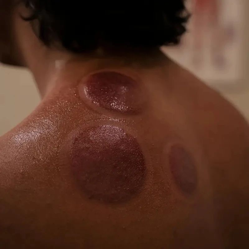 12Pcs Vacuum Cupping Sets with Pumping Gun Suction Cups Back Massage Body Cup Detox Anti Cellulite Cans Healthy Care Jars Health Care And Physical Therapy Massage Tools