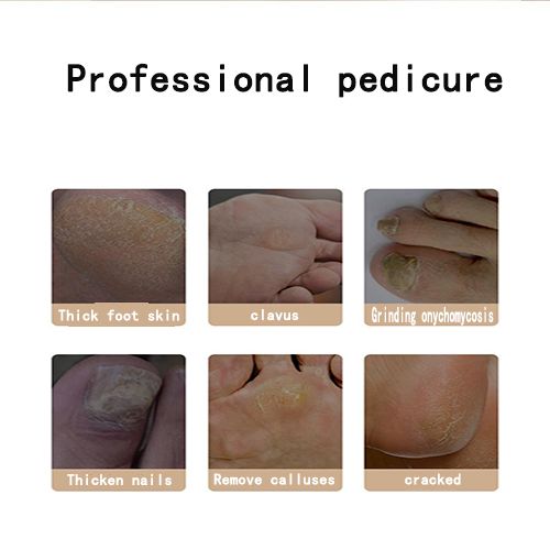 Electric Foot Grinder Foot Care Pedicure Device Callus Remove Artifact for Removing Dead Skin Machine and Calluses Foot Trimmer USB Rechargeable Foot Massager