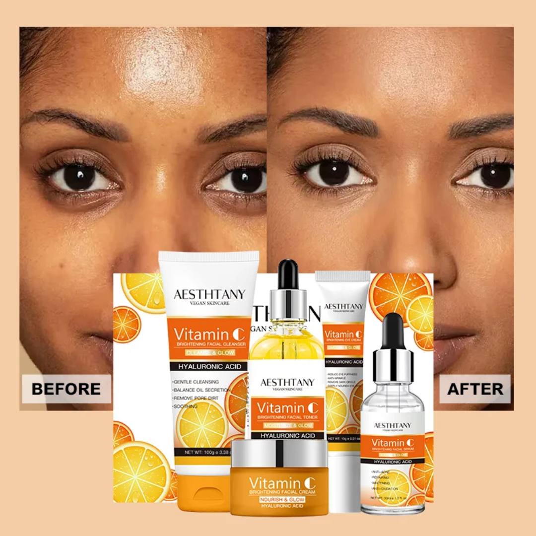 Vitamin C Skincare Set 5pcs – Brightening & Hydrating Kit with Cleanser, Toner, Serum, Cream & Eye Cream