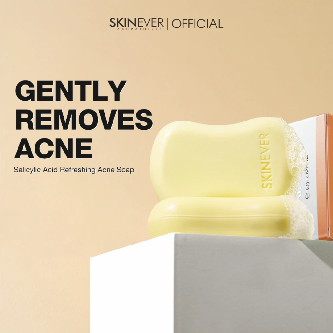 Salicylic Acid Acne Treatment Soap Bar 50g | Oil Control, Deep Pore Cleansing, Blackhead & Pimples Removal | For Oily & Acne-Prone Skin