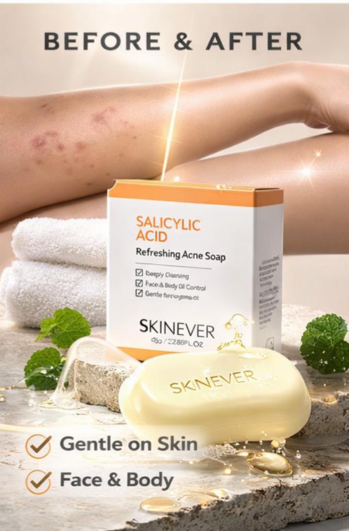 Salicylic Acid Acne Treatment Soap Bar 50g | Oil Control, Deep Pore Cleansing, Blackhead & Pimples Removal | For Oily & Acne-Prone Skin