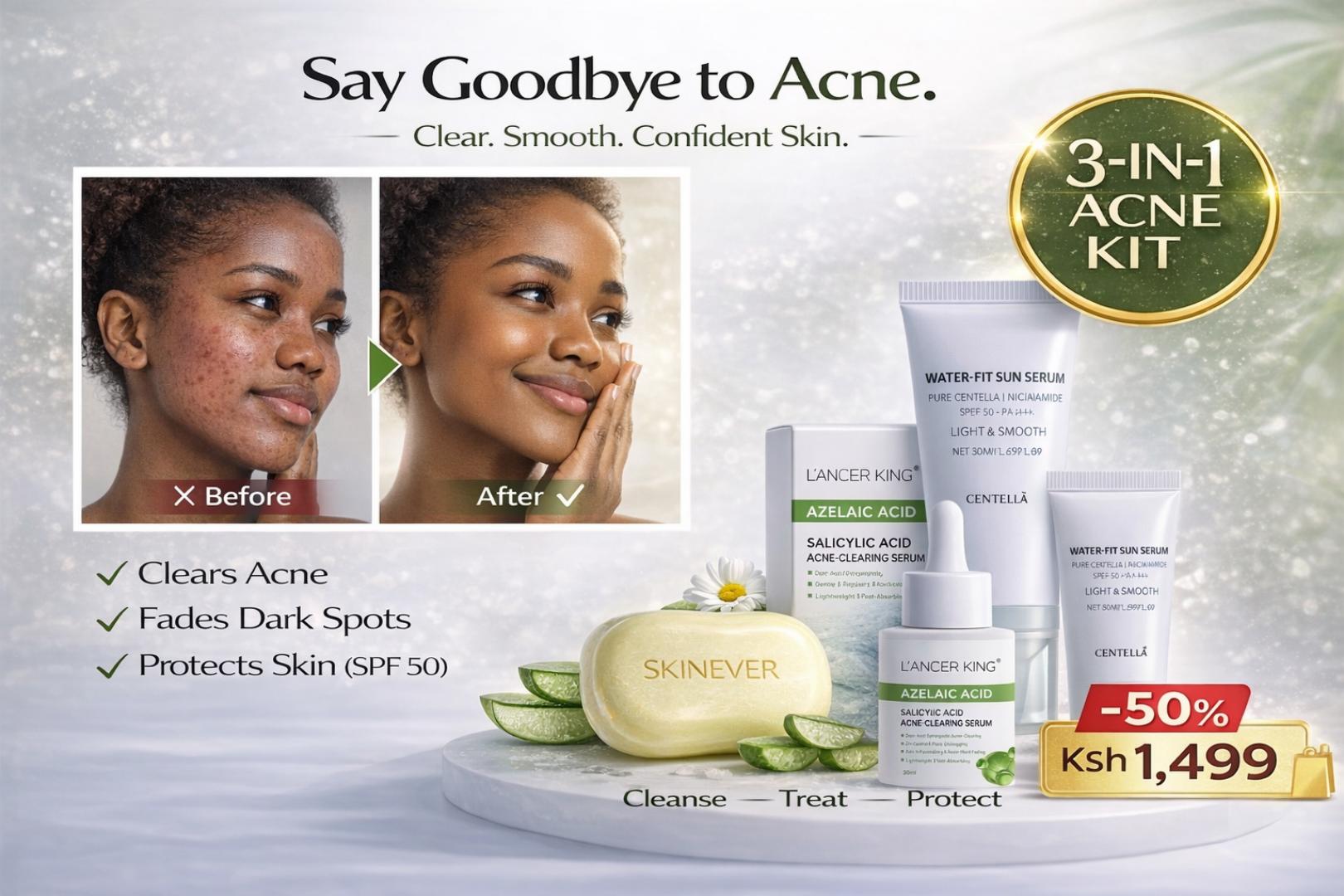 3-in-1 Acne Treatment Kit – Salicylic Soap + Azelaic Serum + SPF50 Sunscreen for Clear Skin