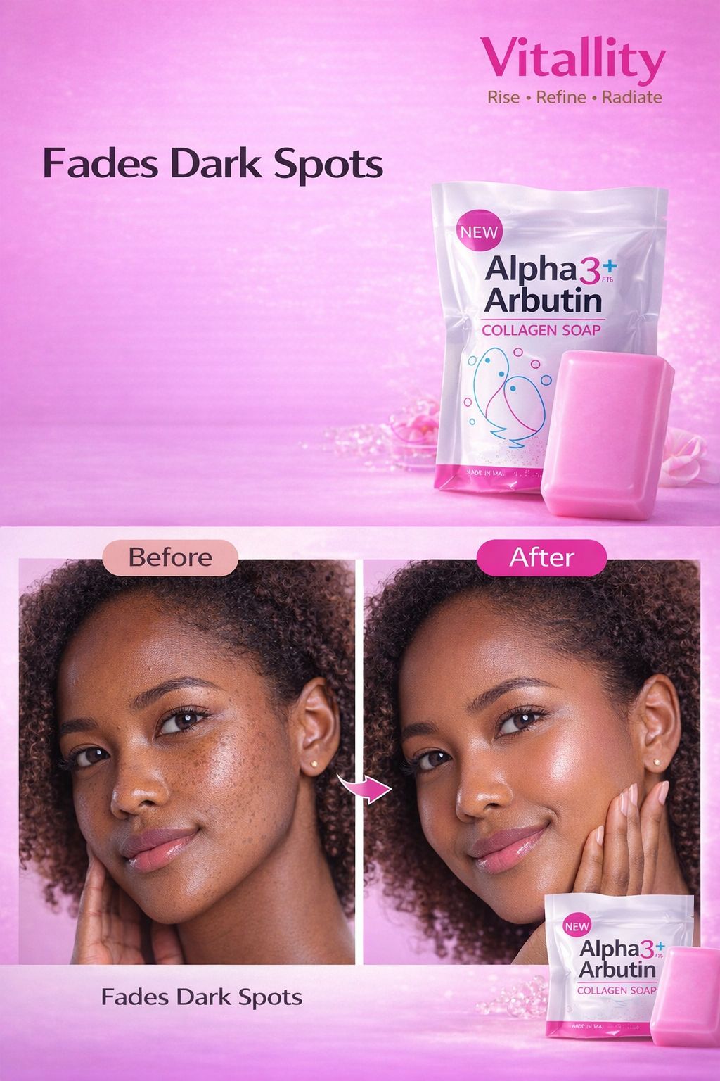 Alpha Arbutin Collagen Soap – Brightening & Dark Spot Remover, Acne Scar Repair, Even Skin Tone Whitening Soap (All Skin Types)