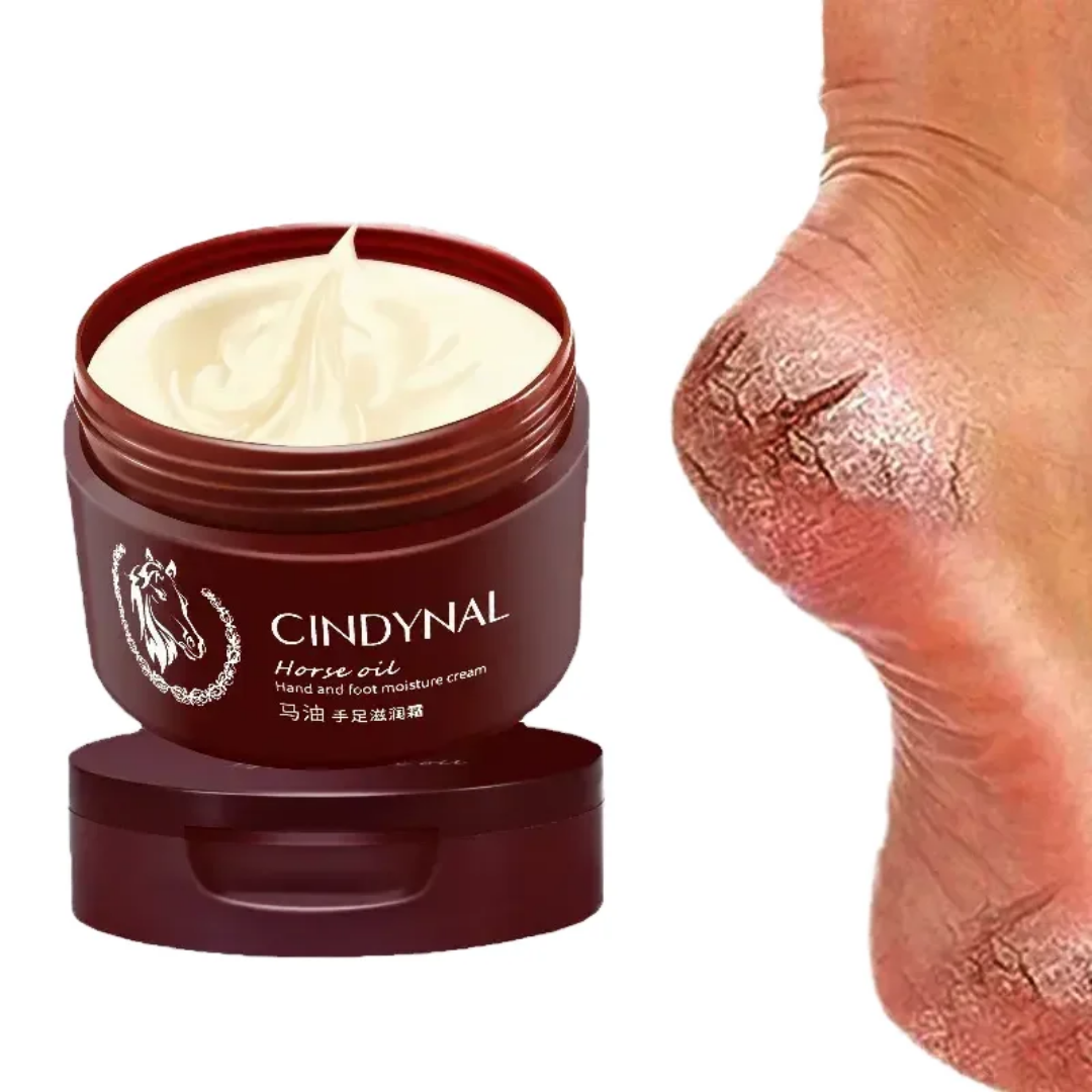 Horse Oil Foot Cream for Cracked Heels | Deep Moisturizing Repair Cream for Dry Skin, Hands & Feet | Smooth Soft Skin Treatment