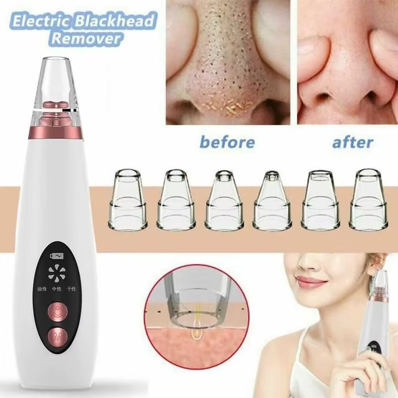 Electric Facial Blackhead Remover Vacuum Pore Cleaner Pimple Removal Vacuum Suction Tools USB Charger Skin Care Tool