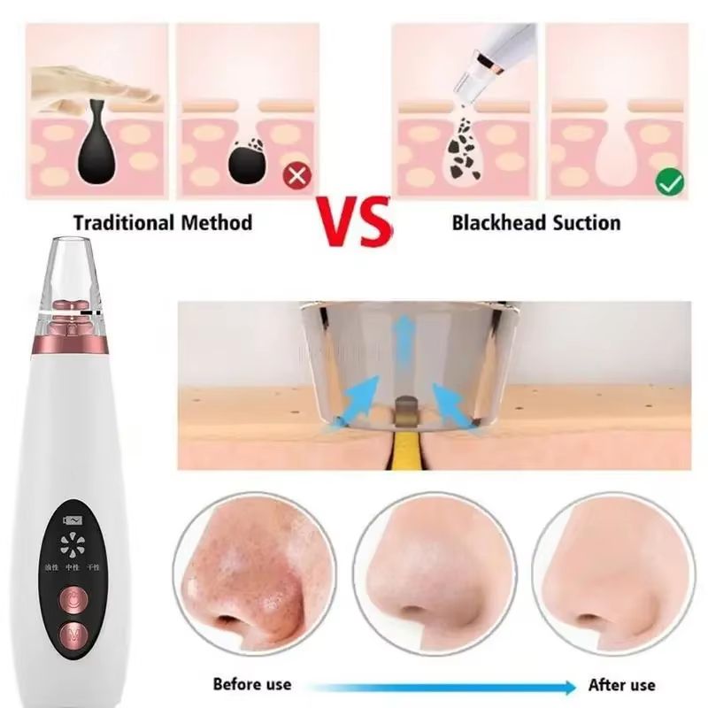 Electric Facial Blackhead Remover Vacuum Pore Cleaner Pimple Removal Vacuum Suction Tools USB Charger Skin Care Tool