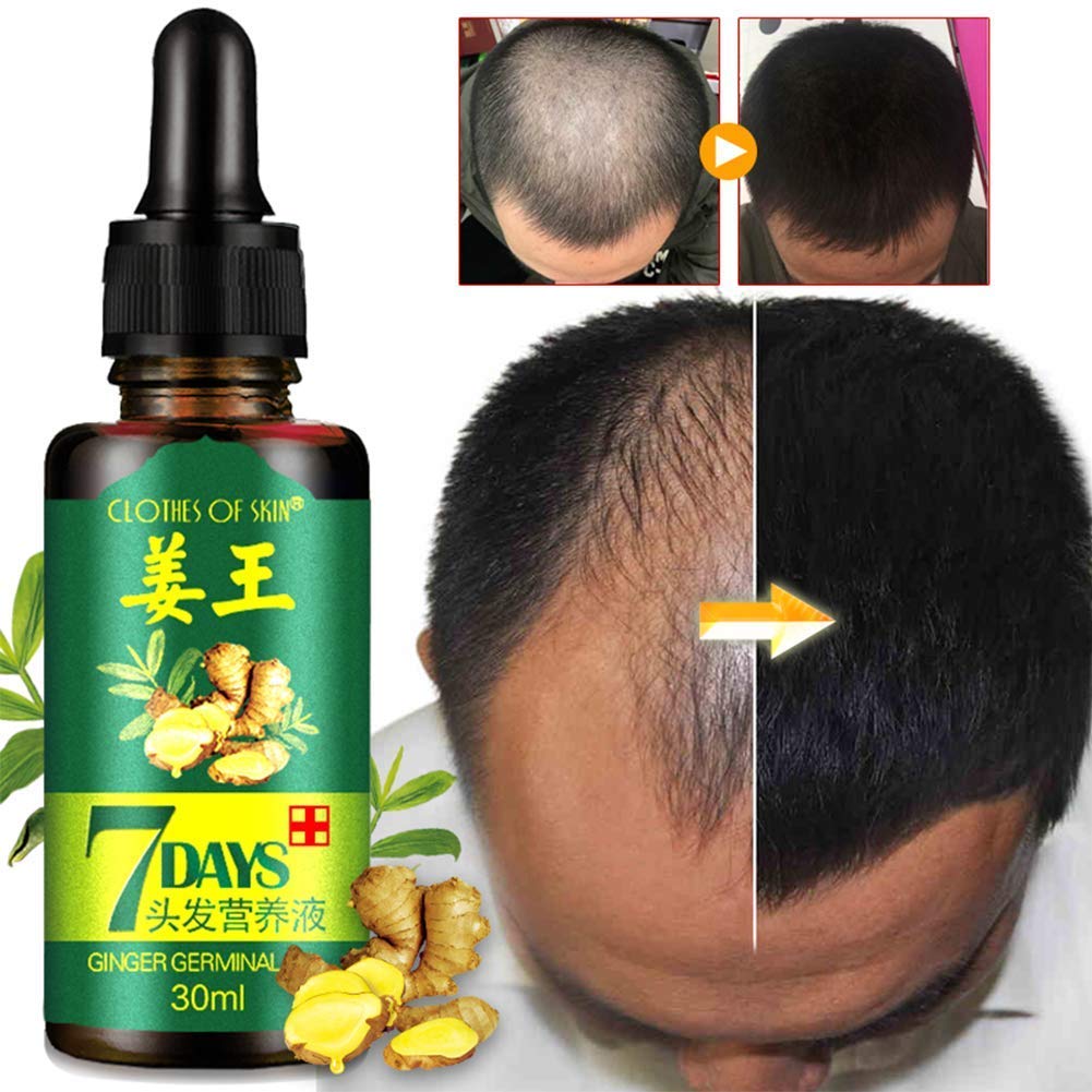 7 Days Germinal Hair & Beard Growth Oil Prevent Hair Loss Treatment Oil.