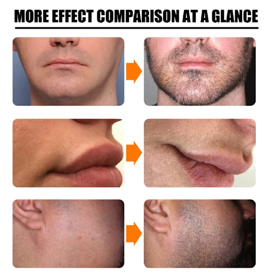 Men Beard Growth Roller Set Beard Growth Kit Men's Beard Growth Essence Nourishing Enhancer Beard Oil Spray Beard Care Set