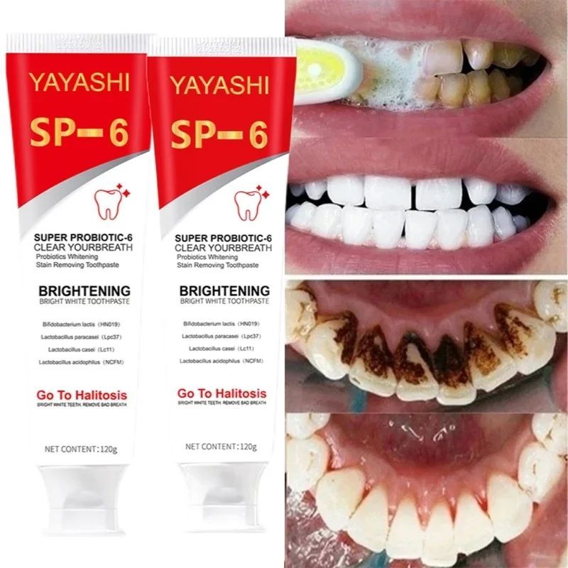 Sp 6 Probiotic Brightening Toothpaste Tooth Whitening Plaque Stains Remover Improves Yellow Teeth Lasting Oral Refreshing Care B2-971