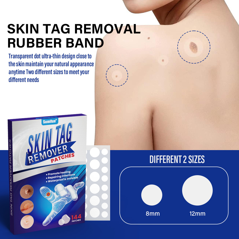 Sumifun wart patch, skin mole cleaning and care, removing corns, thorns, warts, fleshy warts, sharp warts, filamentous warts