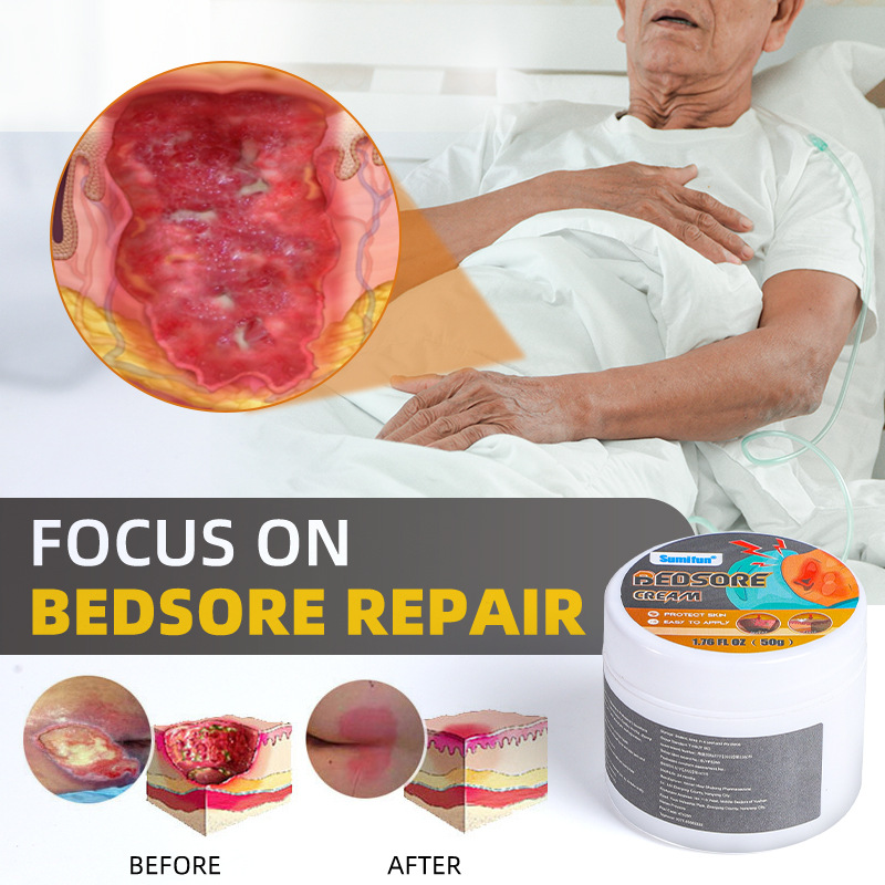 sumifun decubitus ointment special ointment pressure sore ointment care nursing elderly buttocks antibacterial ointment
