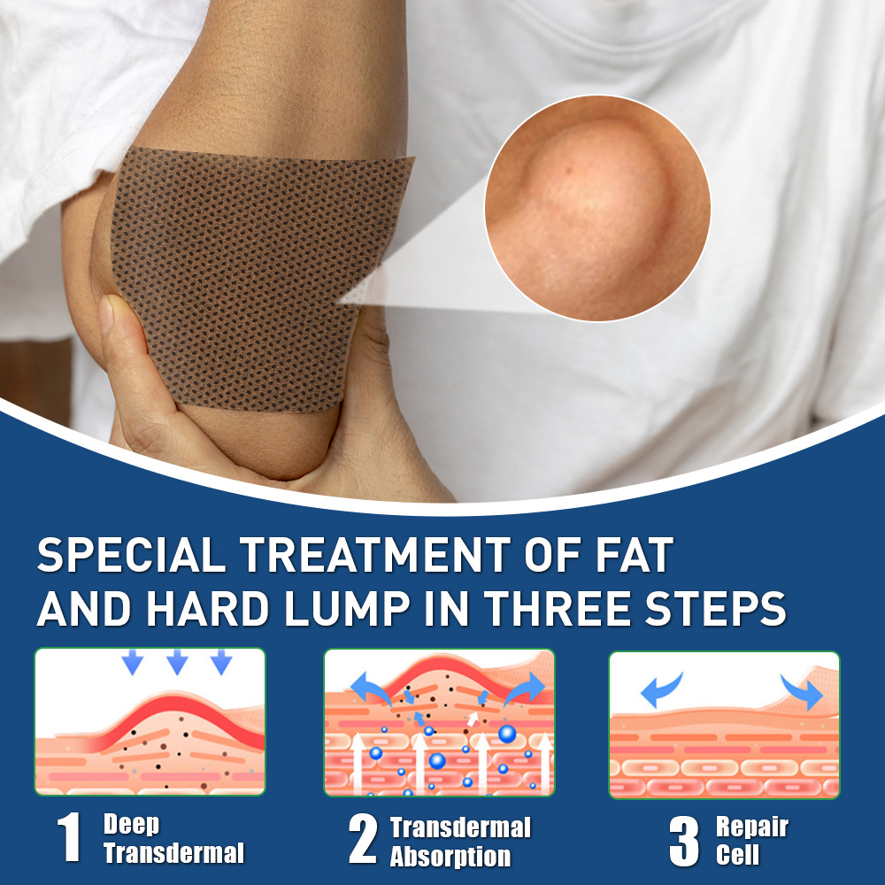 sumifun lipoma patch, fat particle agglomeration patch  sumifun lipoma patch, fat particle agglomeration patch