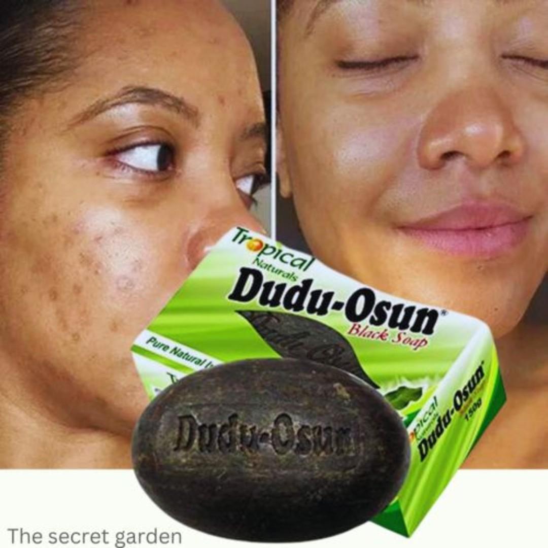 Best price for Dudu-Osun Natural African Black Soap For Pimples/Acne ...