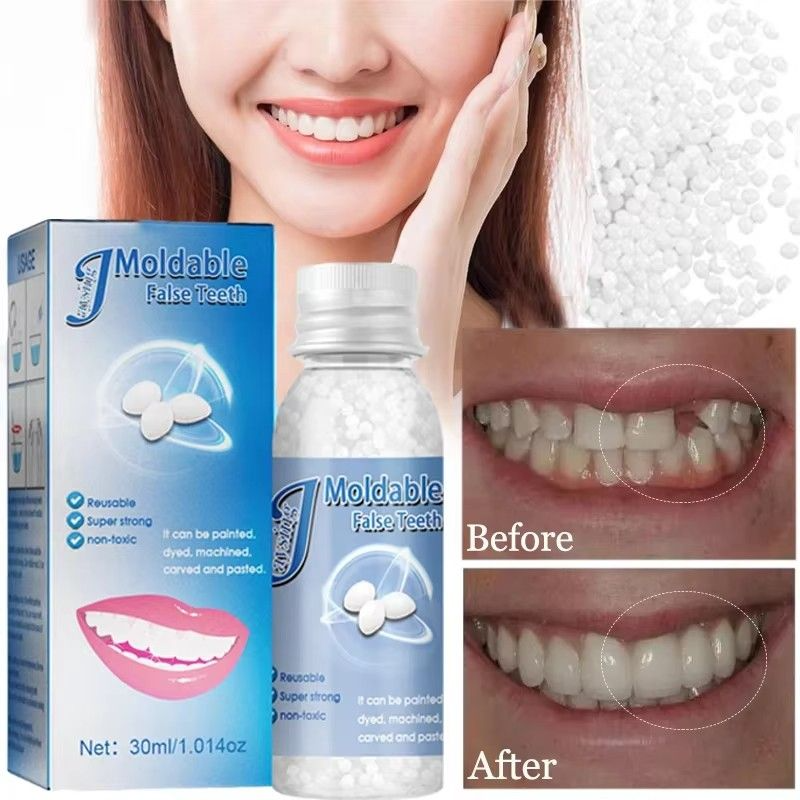 30ml Resin Temporary Tooth Repair Granules Teeth Gaps Missing Broken Tooth False Teeth Filling Moldable Solid Glue Dental Care