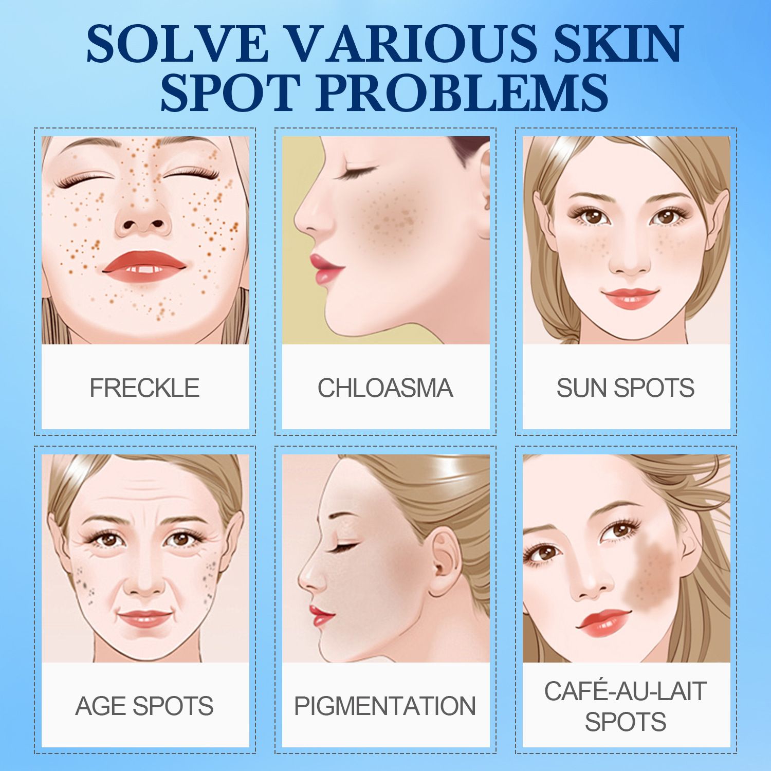 Effective Whitening Cream To Remove Melasma Acne Spot Pigment Melanin Black Spot Pigmentation Moisturizing Cream