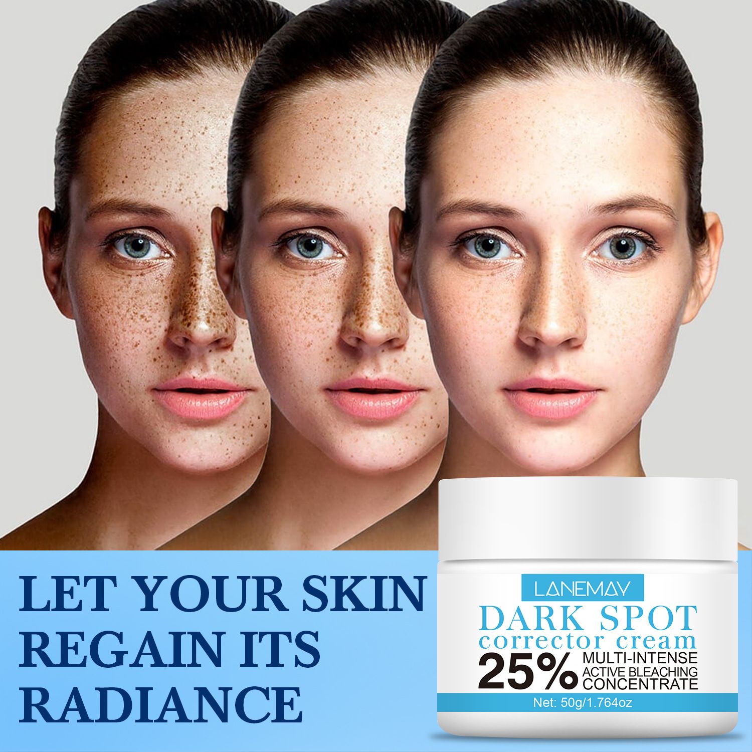Effective Whitening Cream To Remove Melasma Acne Spot Pigment Melanin Black Spot Pigmentation Moisturizing Cream