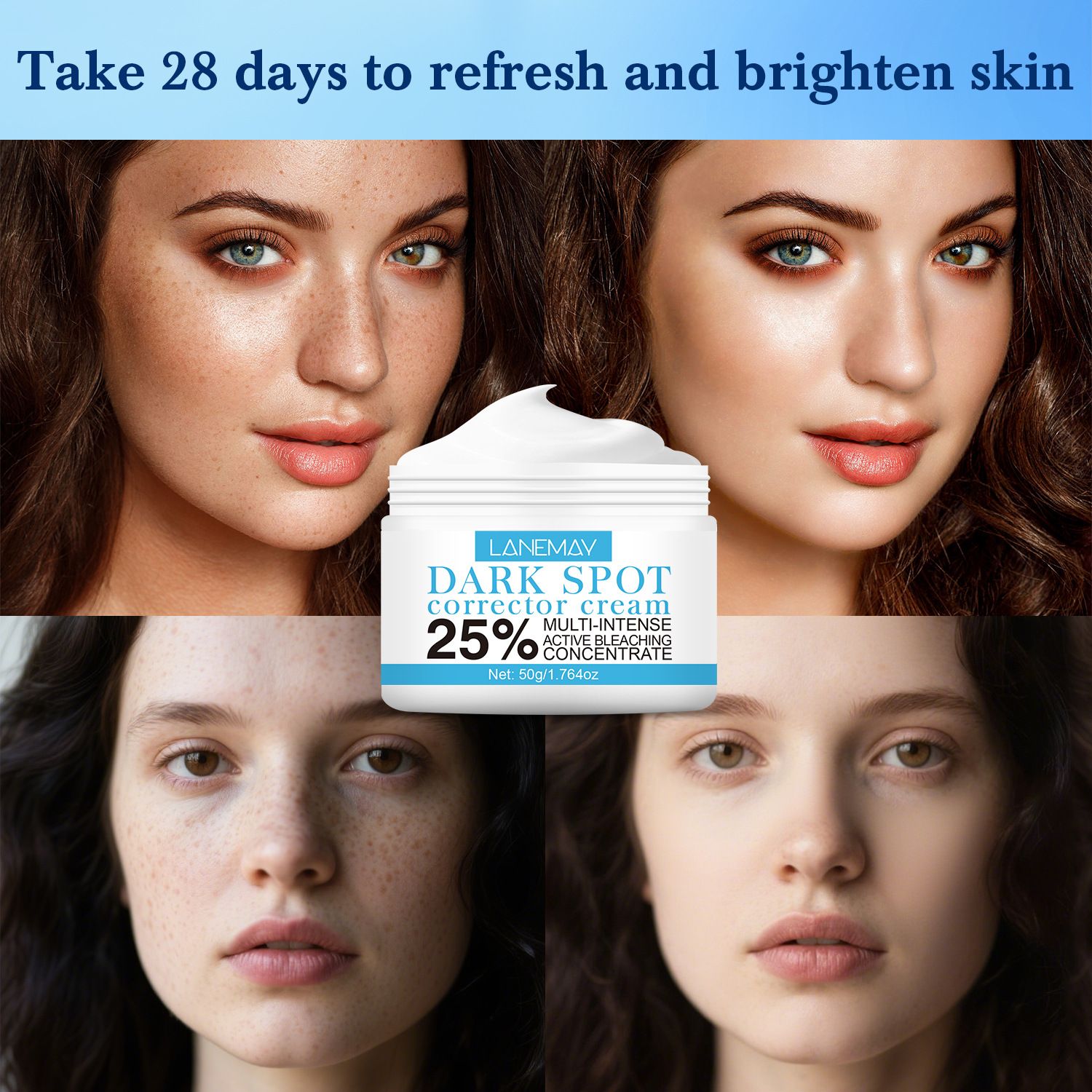 Effective Whitening Cream To Remove Melasma Acne Spot Pigment Melanin Black Spot Pigmentation Moisturizing Cream