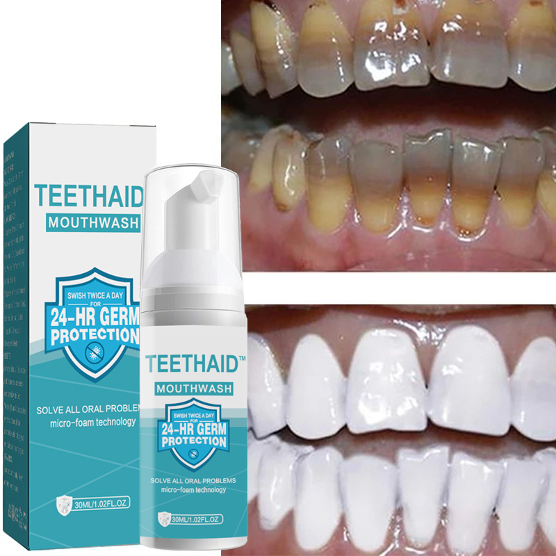 Teeth Whitening Mousse Deep Cleaning Dental Stains Plaque Repair Yellow Tooth Brightening Oral Gums Care Fresh Breath Toothpaste