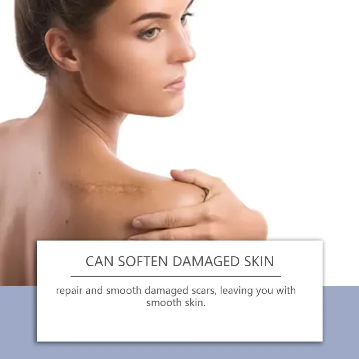 Medical-Grade Silicone Scar Gel for Surgery, C-Section & Keloids | Advanced Scar Cream with Onion Extract | Visibly Minimizes Old & New Scars, Stretch Marks & Bumps